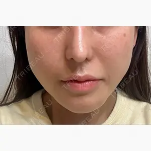 ルラ美容クリニック 大阪本院口コミ