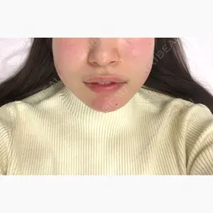 ルラ美容クリニック 大阪本院口コミ