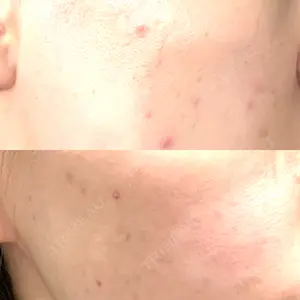 東京美容クリニック 表参道本院口コミ