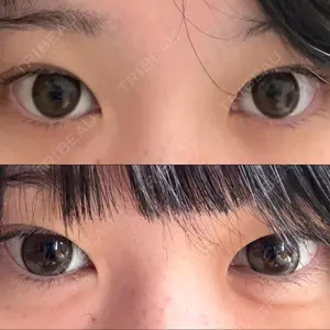 フィラークリニック 大阪心斎橋院口コミ