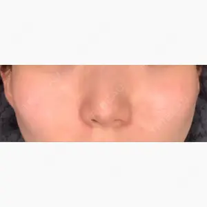 メディアージュクリニック 青山院口コミ