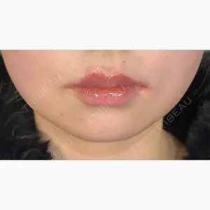 アリエル美容クリニック 大宮院口コミ