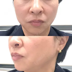 メディアージュクリニック 青山院口コミ