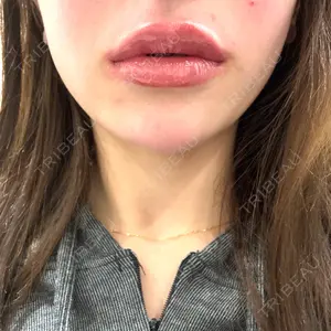 HAAB×DREAM BEAUTY CLINIC 大阪梅田院口コミ