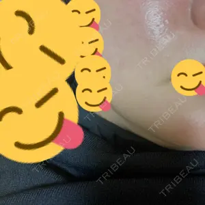 DAILY SKIN CLINIC 心斎橋院口コミ