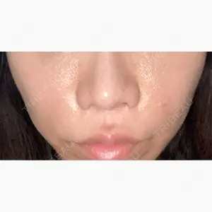 PRO CLINIC プロクリニック 銀座院口コミ