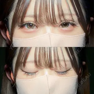 アリエル美容クリニック 大宮院口コミ