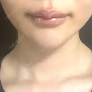 L‘amour clinic Tokyo【ラムールクリニック東京】口コミ