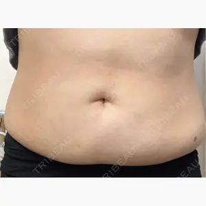 KARIS beauty clinic口コミ