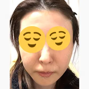 TCB東京中央美容外科 三島院口コミ