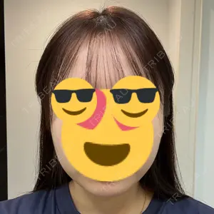 愛知春日井美容外科ネビュラクリニック口コミ