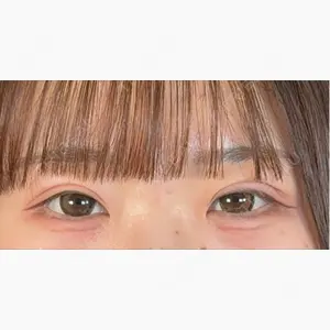 アリエル美容クリニック 大宮院口コミ