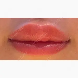 Tokyo Tensei Clinic 新宿院口コミ