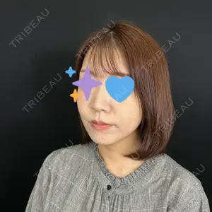 藤・ナチュレ美容クリニック 銀座院口コミ