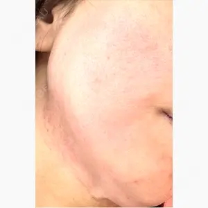 Clinic K Blossom口コミ