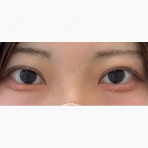 アリエル美容クリニック 大宮院口コミ