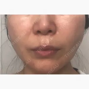 東京ココセランクリニック口コミ