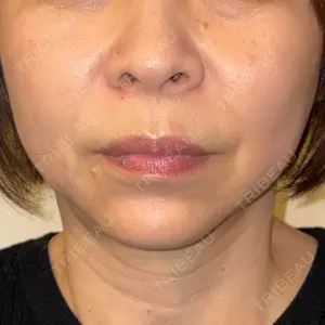 藤・ナチュレ美容クリニック 銀座院口コミ