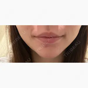 湘南美容クリニック 名古屋院口コミ