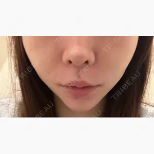 HAAB BEAUTY CLINIC 名古屋院口コミ