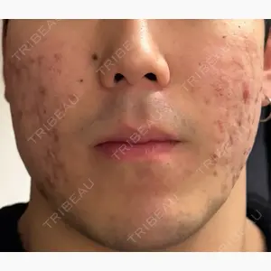 ルラ美容クリニック 広島院口コミ