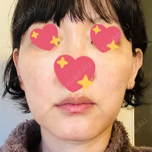 DAILY SKIN CLINIC 心斎橋院口コミ