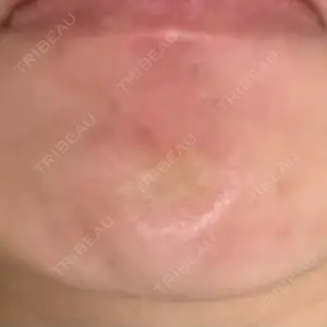 ルラ美容クリニック 渋谷本院口コミ