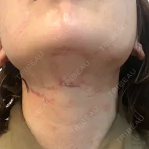 東京美容皮膚科アロエクリニック池袋口コミ