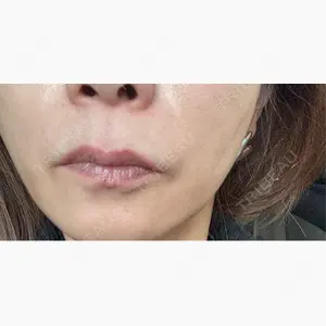 銀座美容外科クリニック 銀座院口コミ