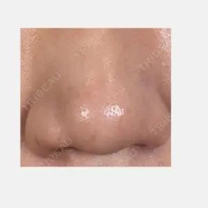 アリエル美容クリニック 大宮院口コミ