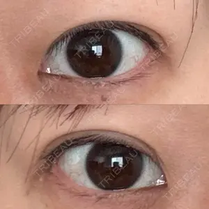 東京シンデレラ美容外科 大宮院口コミ