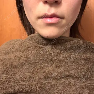 TCB東京中央美容外科 広島院口コミ