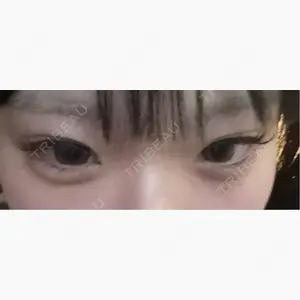 HAAB×DREAM BEAUTY CLINIC 東京本院口コミ