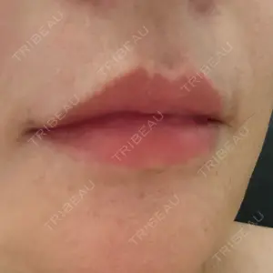 ルラ美容クリニック 静岡院口コミ