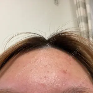 TCB東京中央美容外科 姫路院口コミ