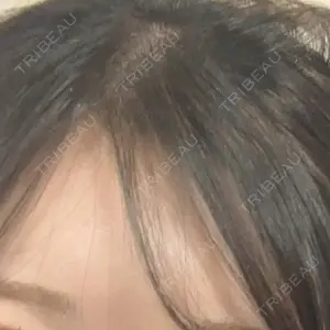 メディカルアルファクリニック口コミ