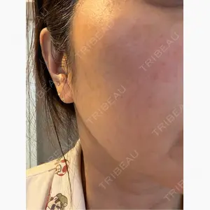 DAILY SKIN CLINIC 心斎橋院口コミ