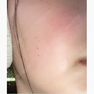 東京シルククリニック 新宿院口コミ