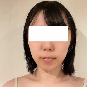 東京美容外科 池袋院口コミ