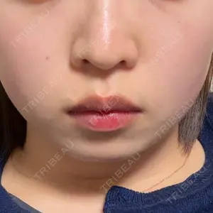 TCB東京中央美容外科 神戸院口コミ