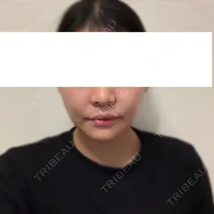 オペラ整形外科口コミ