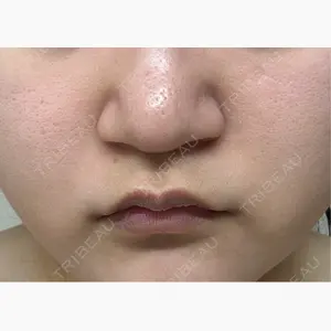 ミニマムスキンクリニック池袋口コミ