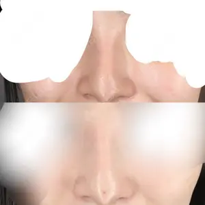 HAAB×DREAM BEAUTY CLINIC 大阪梅田院口コミ