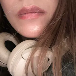 メディカルアルファクリニック口コミ