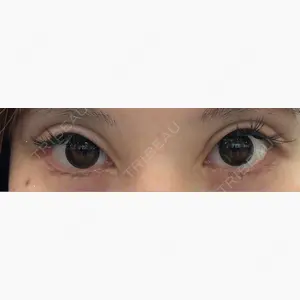 東京シンデレラ美容外科 新宿院口コミ