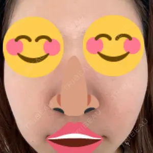 CHARIS BEAUTY CLINIC口コミ