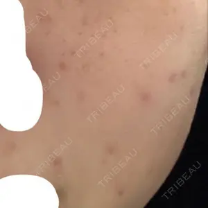 ゆきスキンクリニック 東池袋口コミ