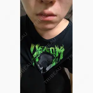 TCB東京中央美容外科 船橋院口コミ