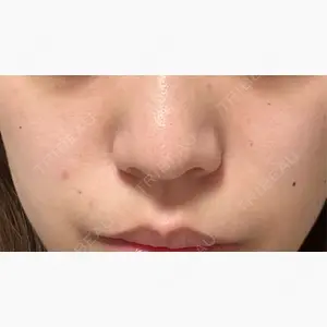 TCB東京中央美容外科 名古屋駅前院口コミ