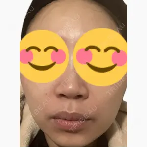 美容皮膚科エルムクリニック 麻布院口コミ